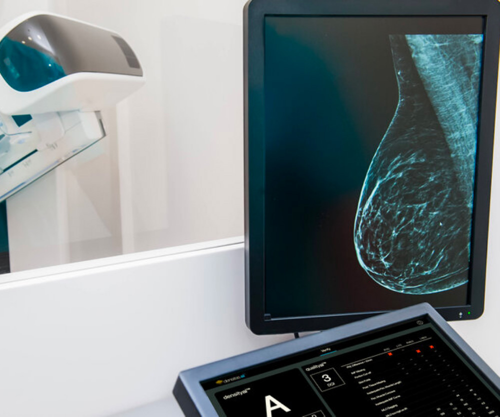 Reduced Mammogram Callbacks
