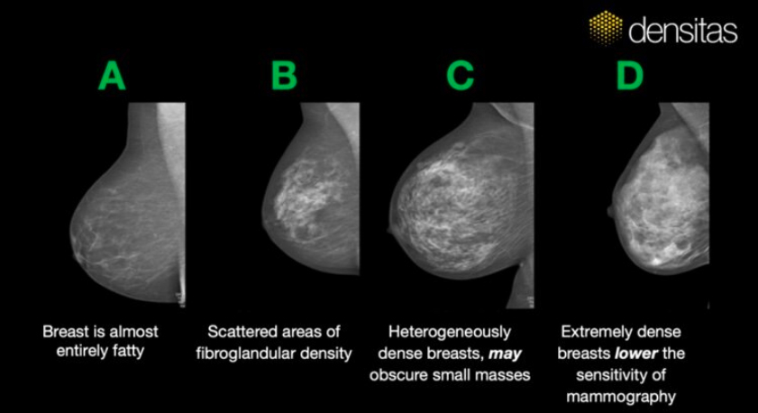 Precision Breast Health with Tailored Follow-Up Screening Protocols