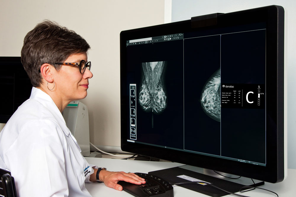 Female radiologist looking at mammograms with BIRADS density C