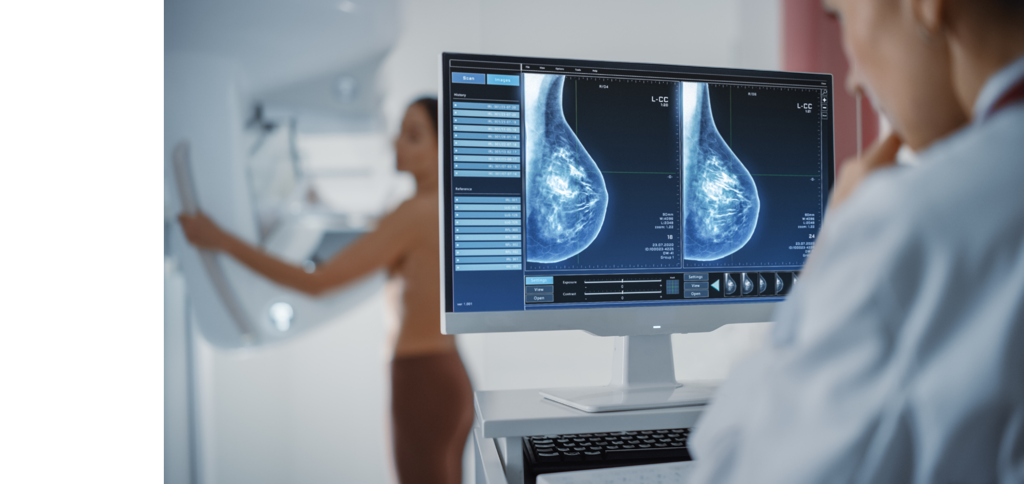 Female radiologist looking at digital mammograms